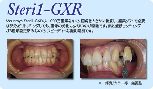 Be摜